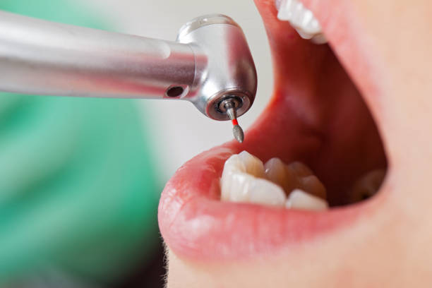 Best Knocked-Out Tooth Emergency  in Holmes Beach, FL